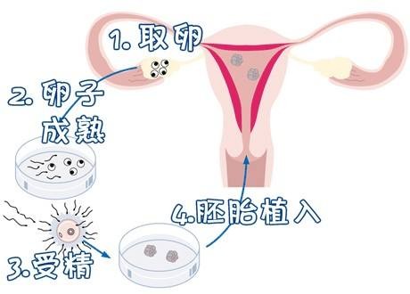 针灸